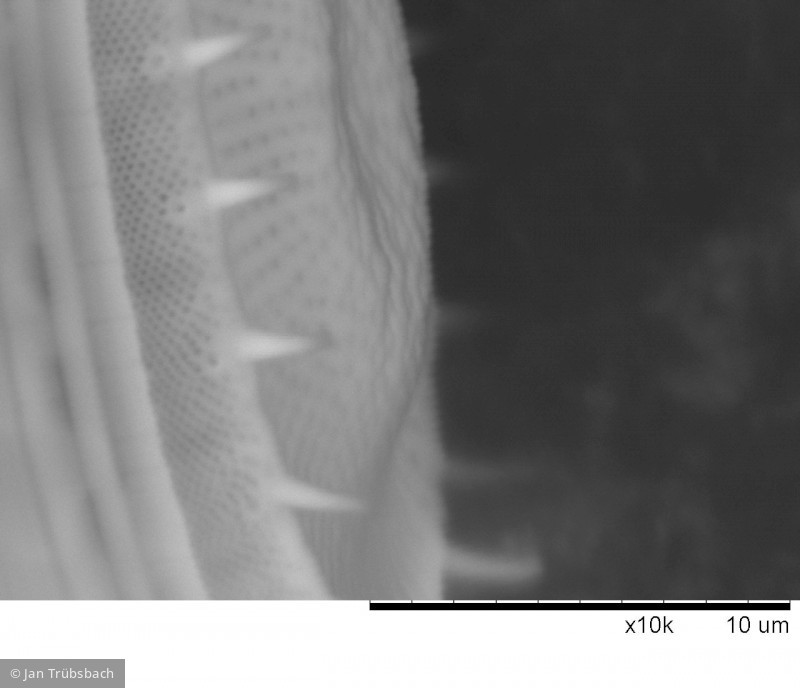 Stephanodiscus_neoastraea_1271401803 - Heterocontophyta Bacillariophyceae Centrales Stephanodiscus neoastraea