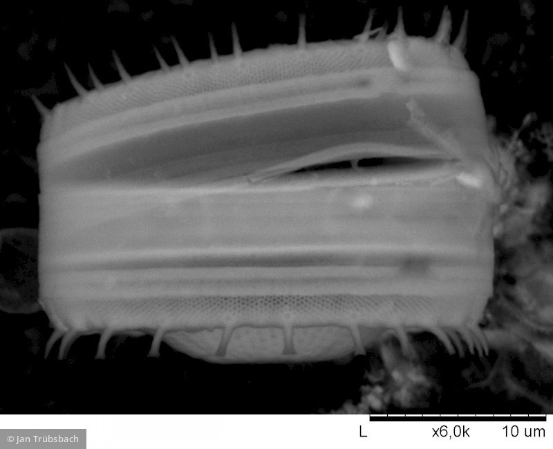 Heterocontophyta Bacillariophyceae Centrales Stephanodiscus neoastraea