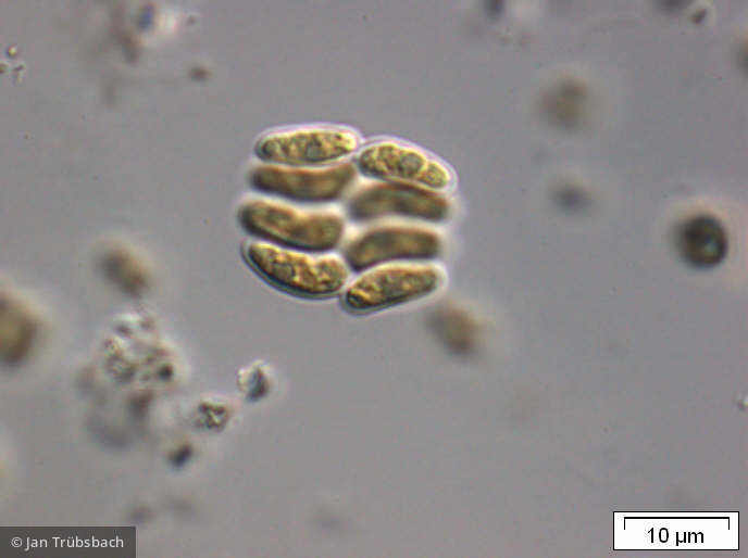 Chlorophyta Chlorophyceae Chlorococcales Scenedesmus obtusus