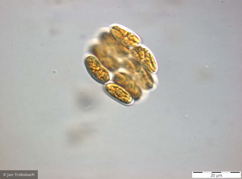 Chlorophyta Chlorophyceae Chlorococcales Scenedesmus obtusus