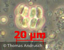 Chlorophyta Chlorophyceae Chlorococcales Scenedesmus obtusus