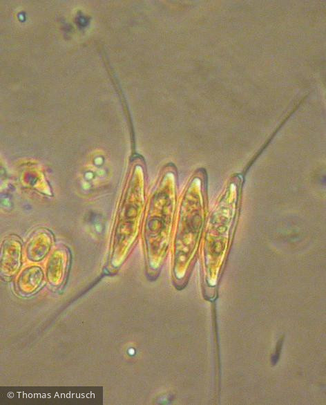 Scenedesmus_opoliensis_1271448562 - Chlorophyta Chlorophyceae Chlorococcales Desmodesmus opoliensis