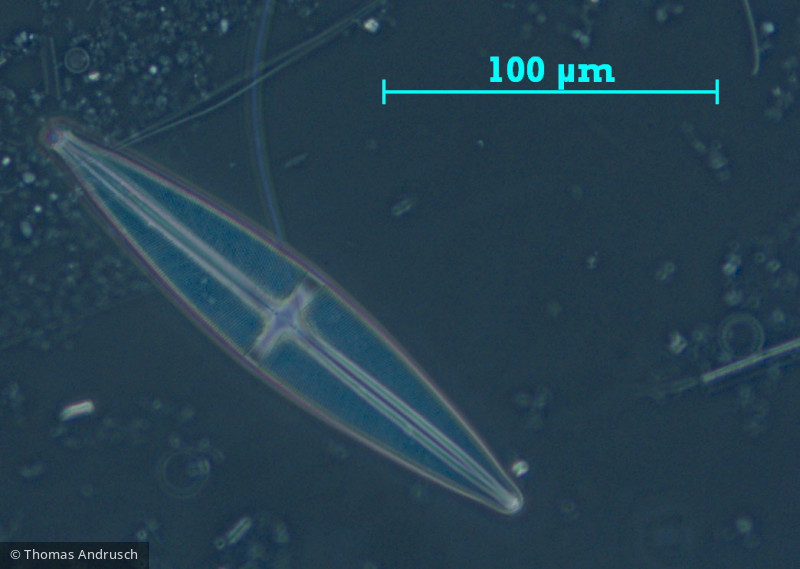 Heterocontophyta Bacillariophyceae Pennales Stauroneis phoenicenteron sensu stricto