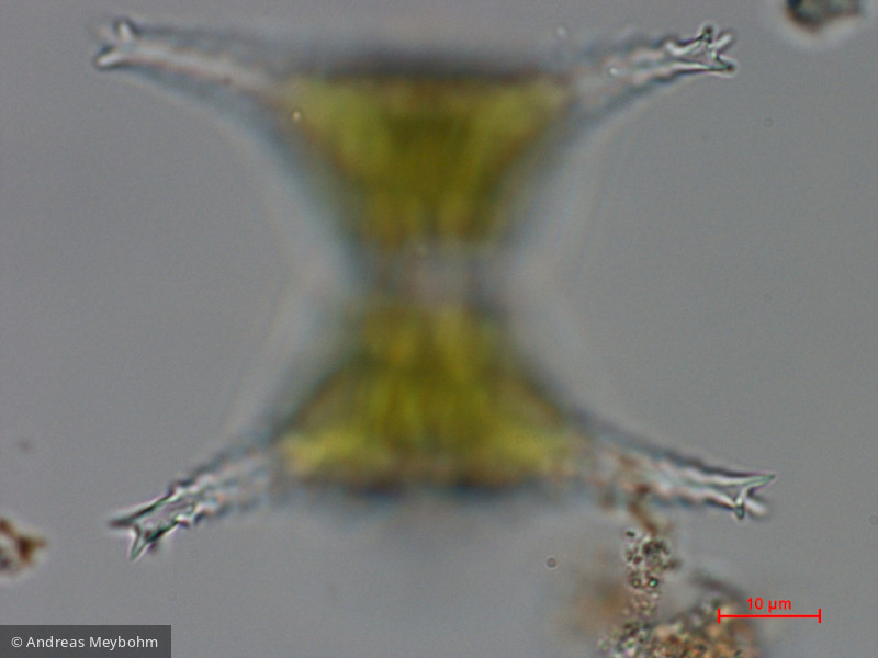 Staurastrum_planktonicum_1286365027