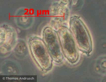 Chlorophyta Chlorophyceae Chlorococcales Scenedesmus praetervisus