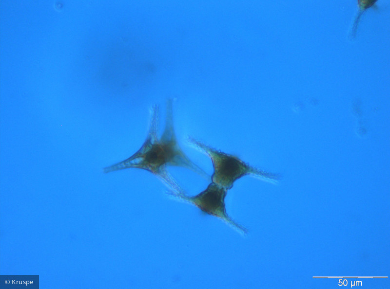 Staurastrum_quadridentatum_1260450736 - Chlorophyta Conjugatophyceae Desmidiales Staurastrum pseudoplanctonicum