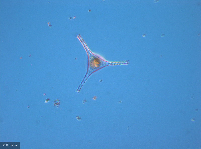 Staurastrum_quadridentatum_1260450960 - Chlorophyta Conjugatophyceae Desmidiales Staurastrum pseudoplanctonicum