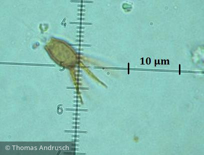 Protista Choanoflagellata Choanoflagellida Salpingoeca ruttneri