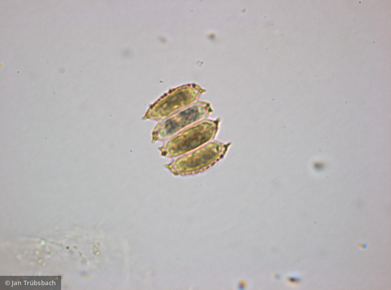 Chlorophyta Chlorophyceae Chlorococcales Desmodesmus serratus