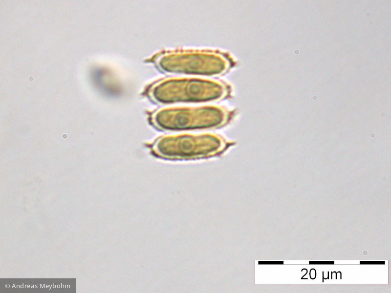 Chlorophyta Chlorophyceae Chlorococcales Desmodesmus serratus