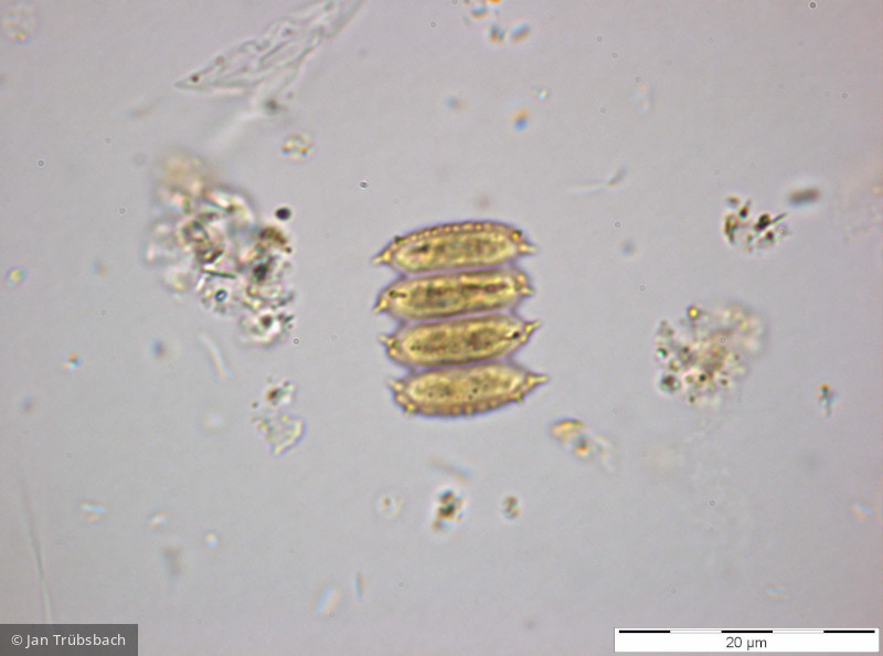 Chlorophyta Chlorophyceae Chlorococcales Desmodesmus serratus