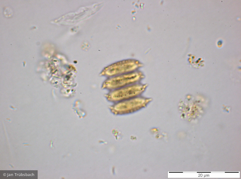 Chlorophyta Chlorophyceae Chlorococcales Desmodesmus serratus