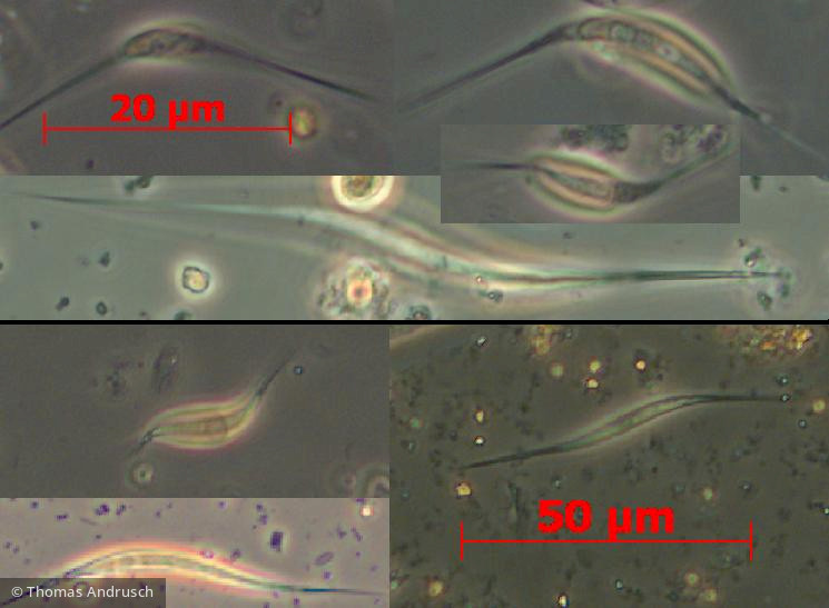 Chlorophyta Chlorophyceae Chlorococcales Schroederia setigera