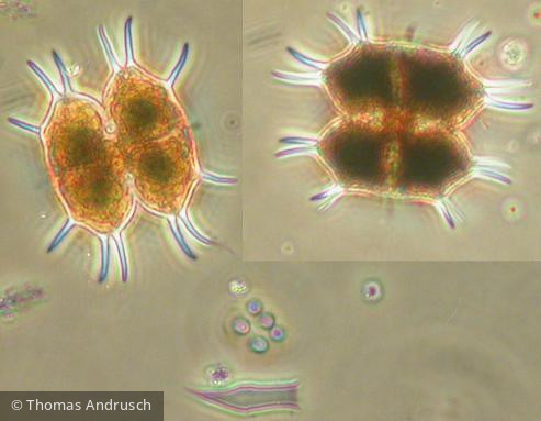 Xanthidium_smithii_1271450389 - Chlorophyta Conjugatophyceae Desmidiales Xanthidium smithii
