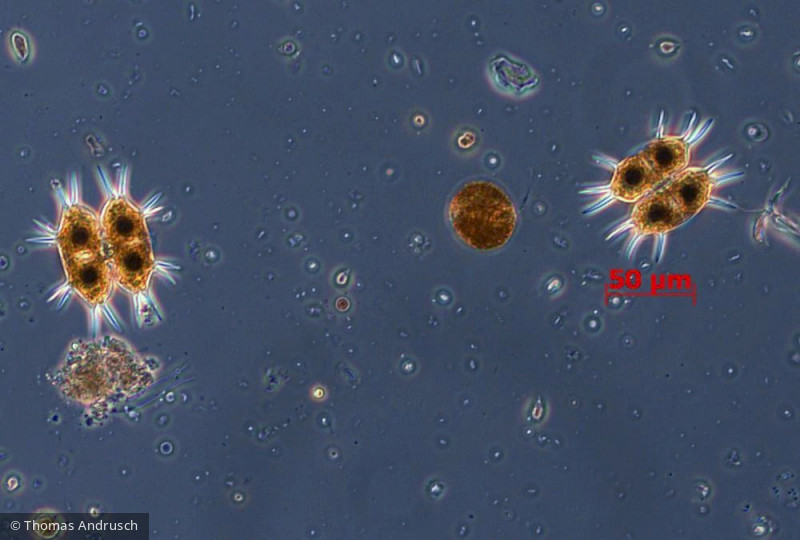 Chlorophyta Conjugatophyceae Desmidiales Xanthidium smithii