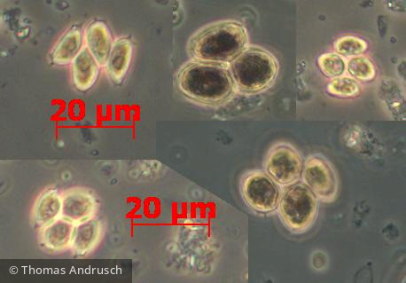 Chlorophyta Chlorophyceae Chlorococcales Scenedesmus smithii