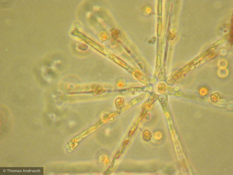 Protista Choanoflagellata Choanoflagellida Salpingoeca sp.