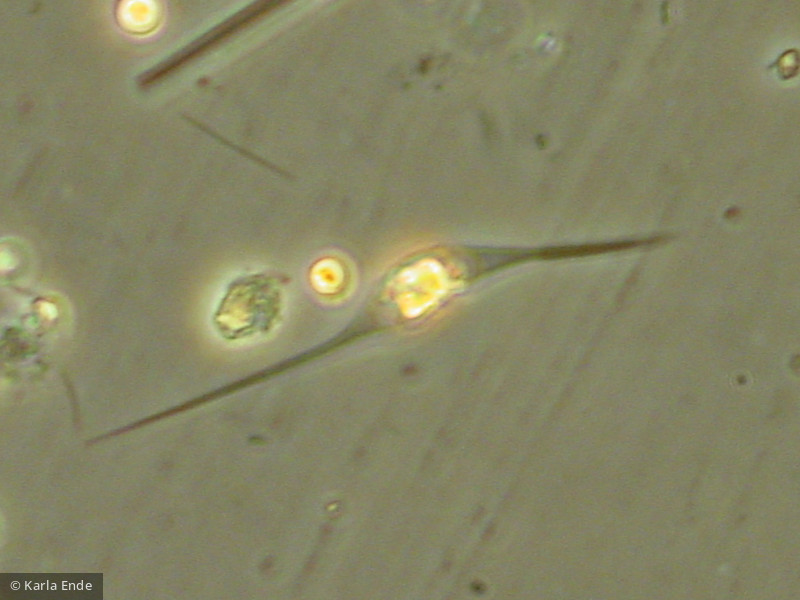 Chlorophyta Chlorophyceae Chlorococcales Schroederia sp.