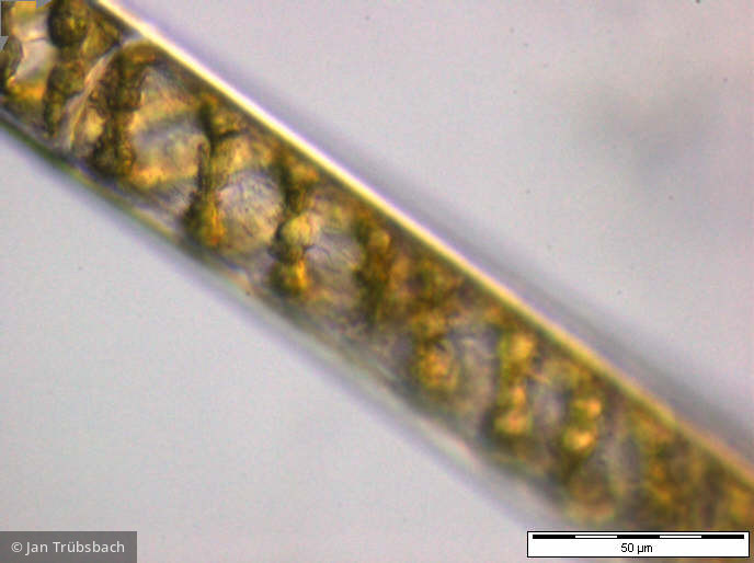 Spirogyra_sp._1252926446 - Chlorophyta Conjugatophyceae Zygnematales Spirogyra sp.