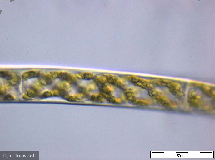 Spirogyra_sp._1252926837 - Chlorophyta Conjugatophyceae Zygnematales Spirogyra sp.