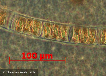 Chlorophyta Conjugatophyceae Zygnematales Spirogyra sp.