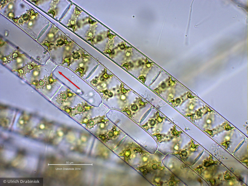 Chlorophyta Conjugatophyceae Zygnematales Spirogyra sp.