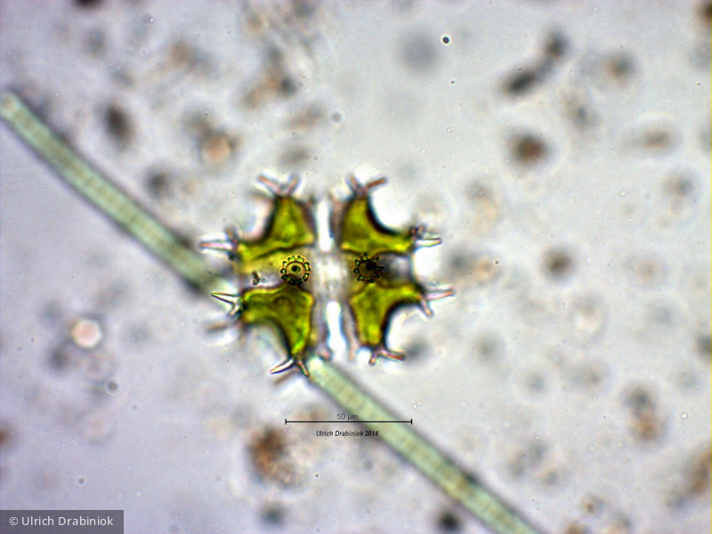 Chlorophyta Conjugatophyceae Desmidiales Xanthidium sp.