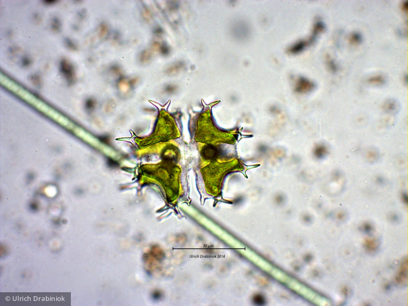 Chlorophyta Conjugatophyceae Desmidiales Xanthidium sp.