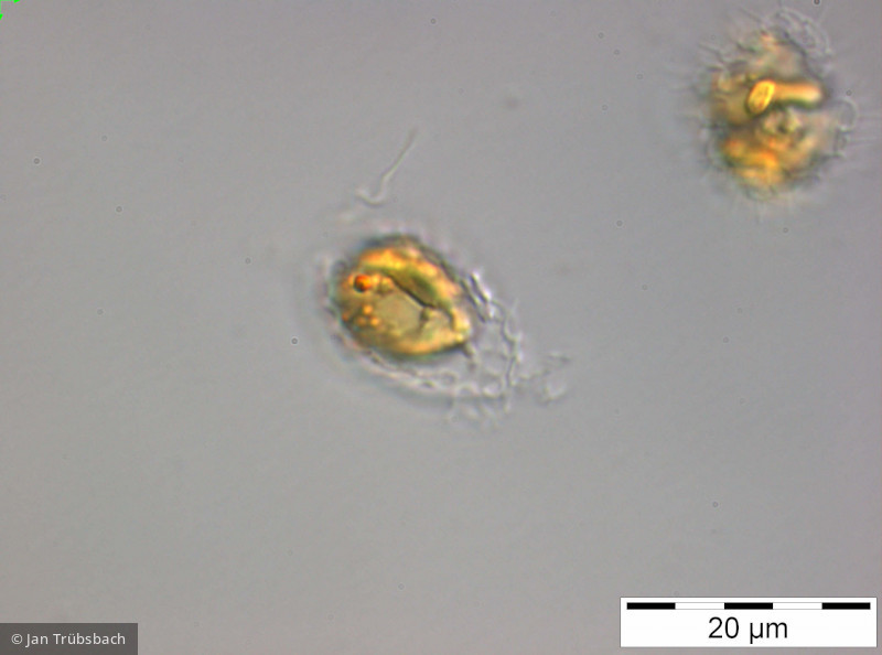 Synura_sphagnicola_1249969054 - Heterocontophyta Chrysophyceae Ochromonadales Synura sphagnicola