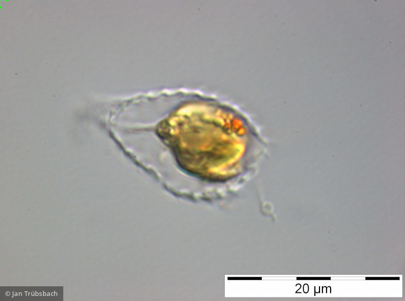 Synura_sphagnicola_1249970293 - Heterocontophyta Chrysophyceae Ochromonadales Synura sphagnicola