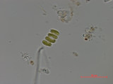 Scenedesmus_spinosus_1286805332