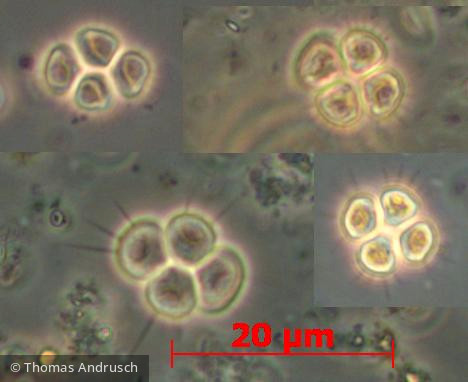Chlorophyta Chlorophyceae Chlorococcales Tetrastrum staurogeniaeforme