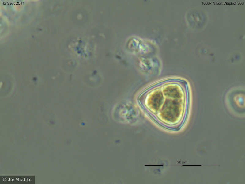 Chlorophyta Chlorophyceae Chlorococcales Tetraedron triangulare