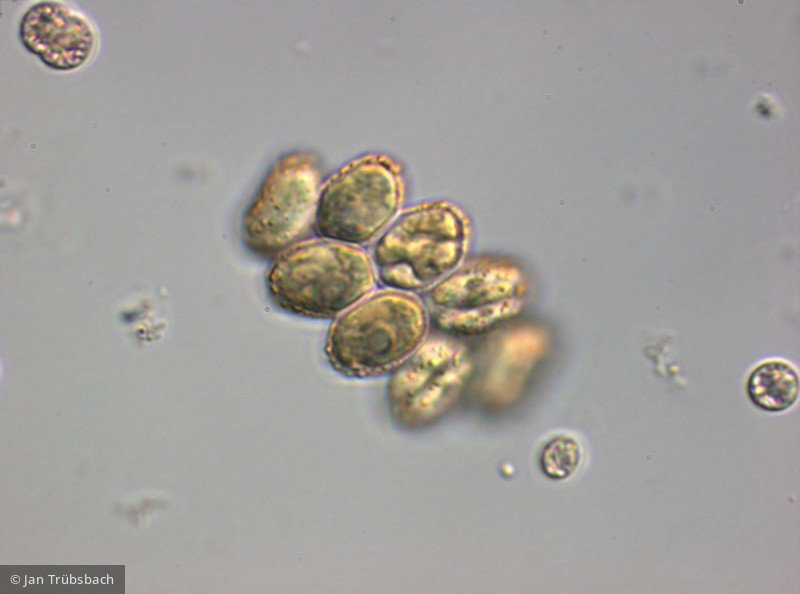 Scenedesmus_verrucosus_1252071608 - Chlorophyta Chlorophyceae Chlorococcales Verrucodesmus verrucosus