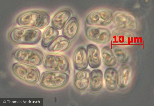 Chlorophyta Chlorophyceae Chlorococcales Willea vilhelmii