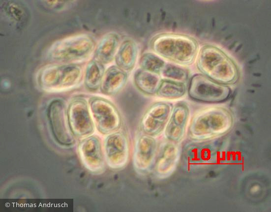 Chlorophyta Chlorophyceae Chlorococcales Willea vilhelmii