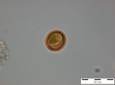 Trachelomonas_volvocina_1255076953