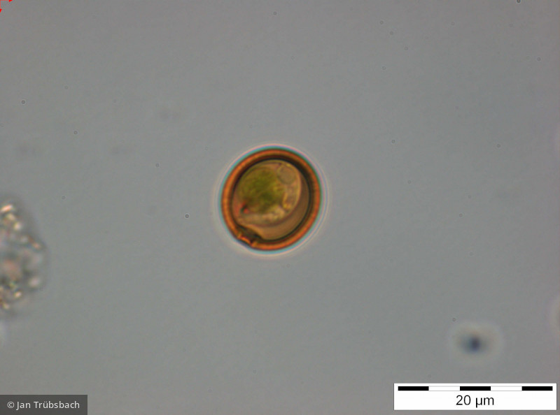 Trachelomonas_volvocina_1255076953 - Euglenophyta Euglenophyceae Euglenales Trachelomonas volvocina