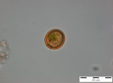 Trachelomonas_volvocina_1255077101