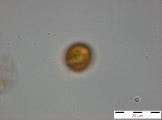 Trachelomonas_volvocina_1255077181