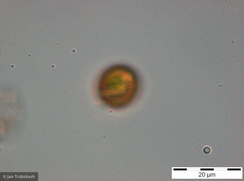 Trachelomonas_volvocina_1255077181 - Euglenophyta Euglenophyceae Euglenales Trachelomonas volvocina