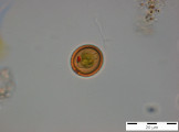 Trachelomonas_volvocina_1255077327