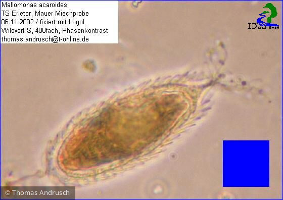 Mallomonas_acaroides_1238666999 - Heterocontophyta Chrysophyceae Ochromonadales Mallomonas acaroides