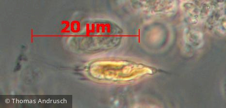 Heterocontophyta Chrysophyceae Ochromonadales Mallomonas akrokomos