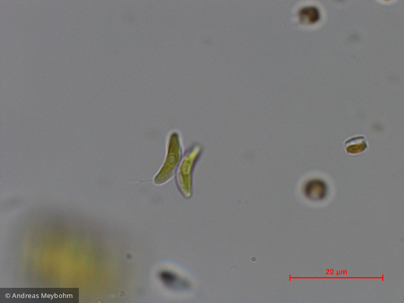 Didymogenes_anomala_1286869463 - Chlorophyta Chlorophyceae Chlorococcales Didymogenes anomala