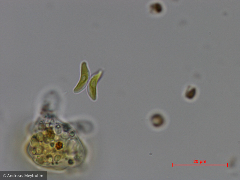 Didymogenes_anomala_1286869590 - Chlorophyta Chlorophyceae Chlorococcales Didymogenes anomala