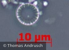 Heterocontophyta Bacillariophyceae Centrales Cyclotella atomus