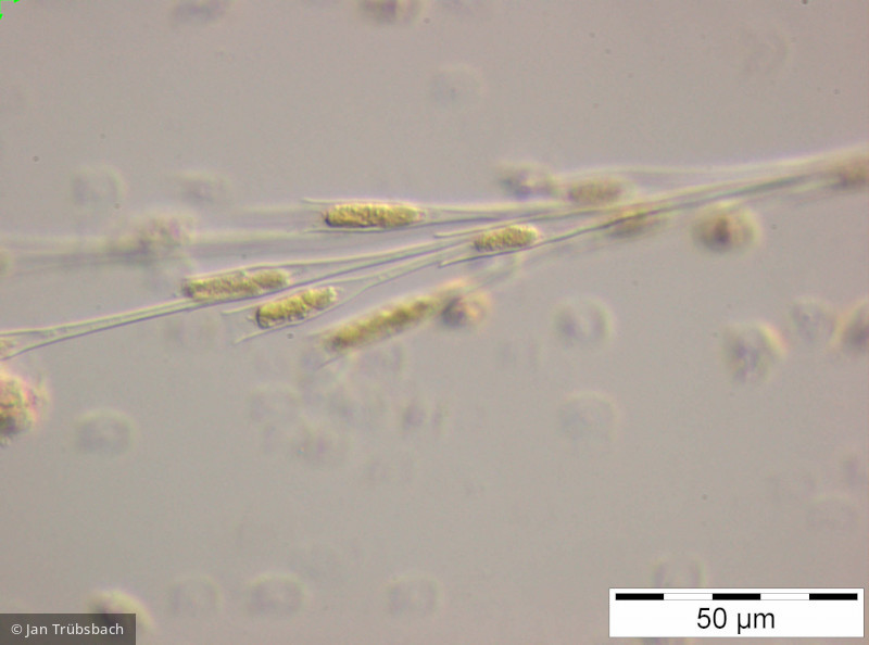 Dinobryon_bavaricum_1248958022 - Heterocontophyta Chrysophyceae Ochromonadales Dinobryon bavaricum