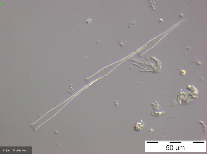 Dinobryon_bavaricum_1250772539 - Heterocontophyta Chrysophyceae Ochromonadales Dinobryon bavaricum