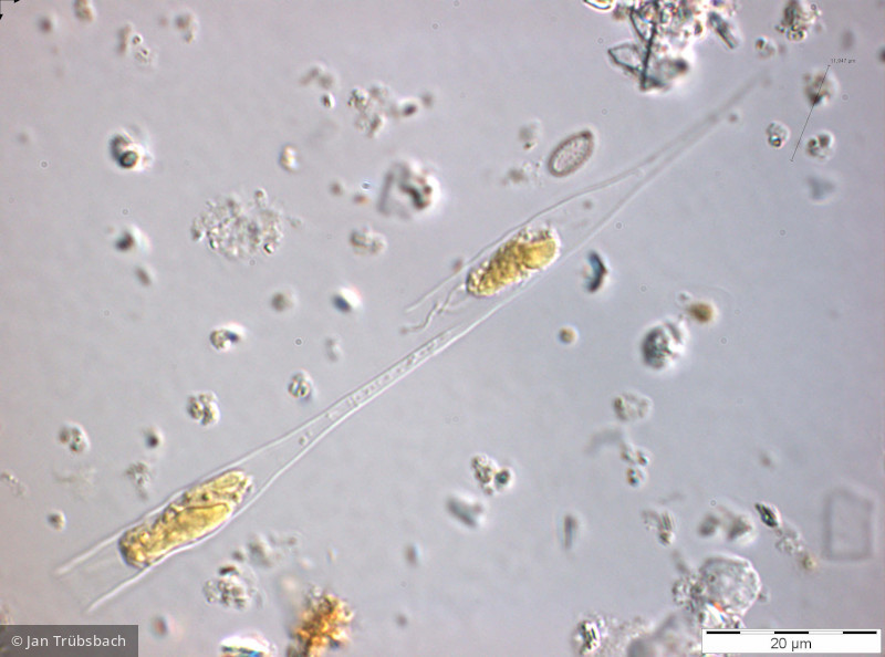 Heterocontophyta Chrysophyceae Ochromonadales Dinobryon bavaricum